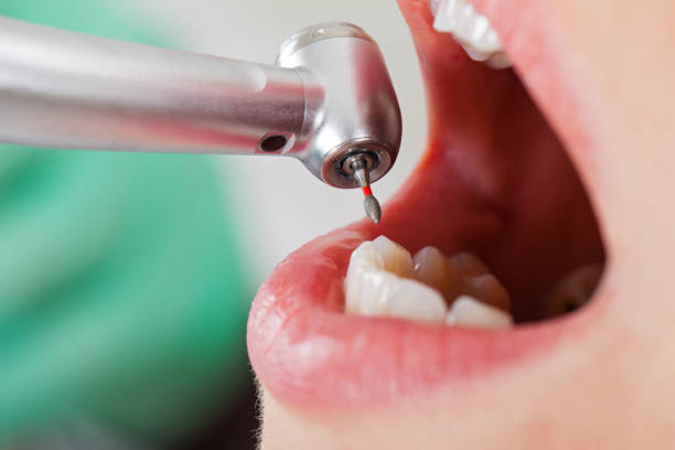 Best Emergency Care for Gum Disease in Pioche, NV